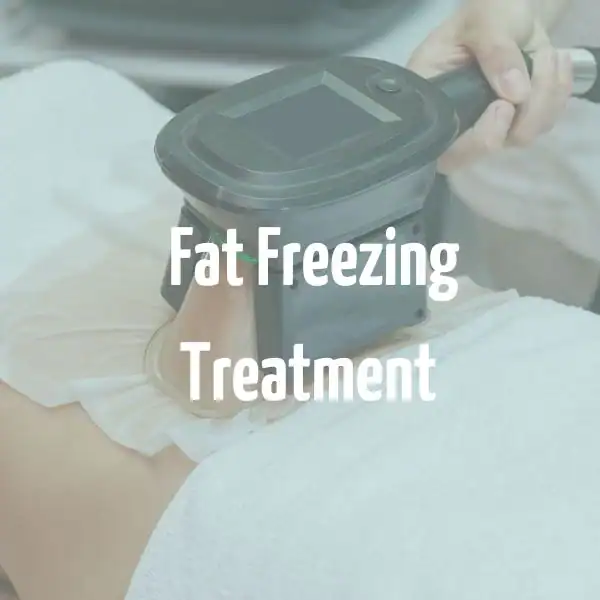 fat freezing treatment Teddington